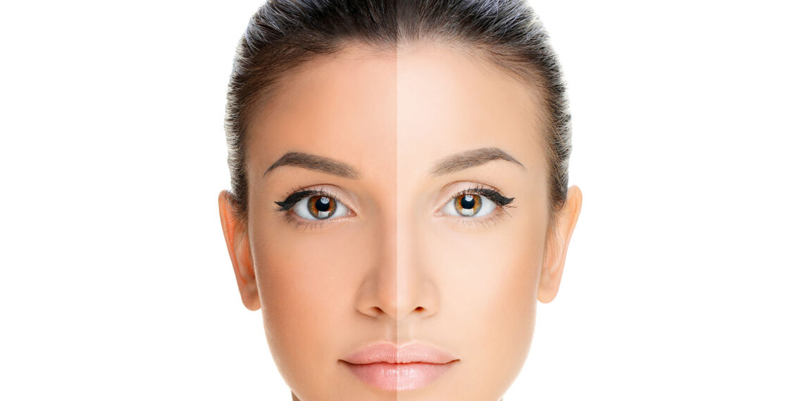 Your Guide to Tan Removal