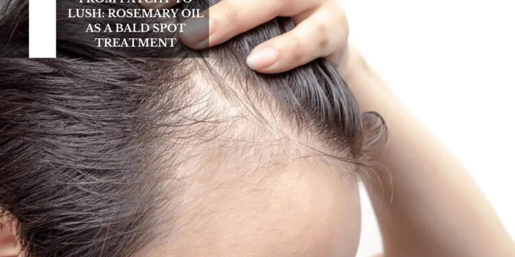 Rosemary Oil As A Bald Spot Treatment
– Moksha Lifestyle Products