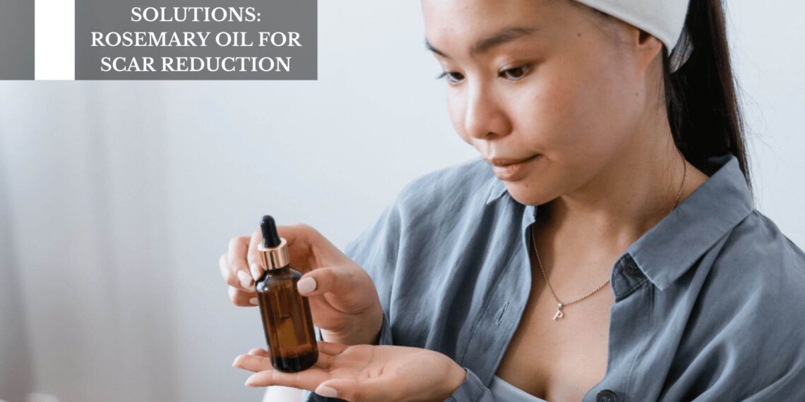 Rosemary Oil For Scar Reduction
– Moksha Lifestyle Products