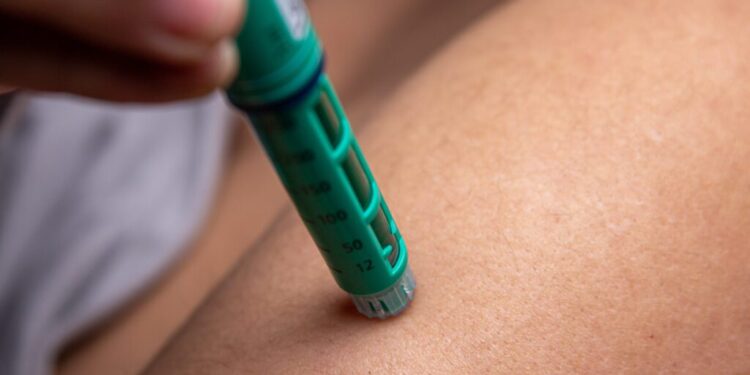 Everything You Need to Know