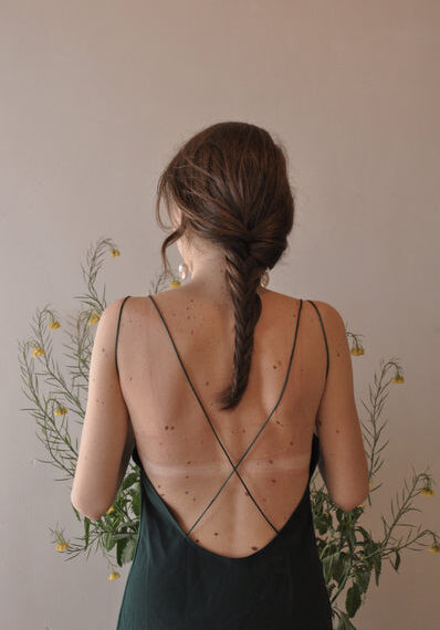 Nutrition for Histamine Relief 🌻 – Remedy Holistic