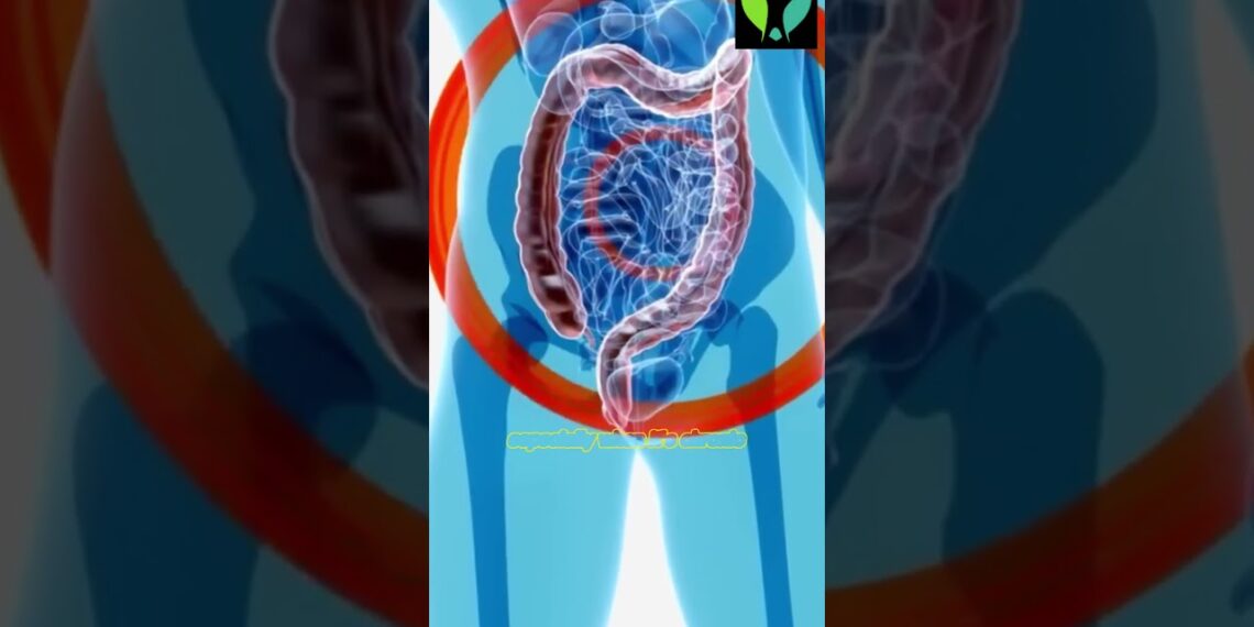 The Ultimate Guide Colon Cleansing Benefits Unveiled By Goodness Nature