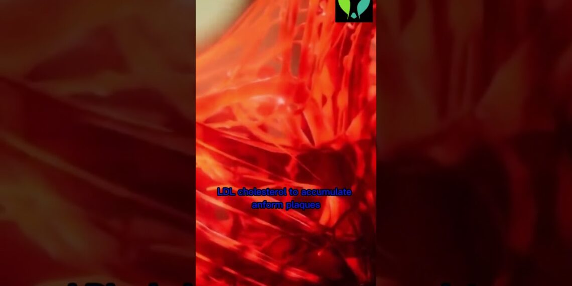 Supercharge Your Health Mastering Cholesterol with Exercise and Diet