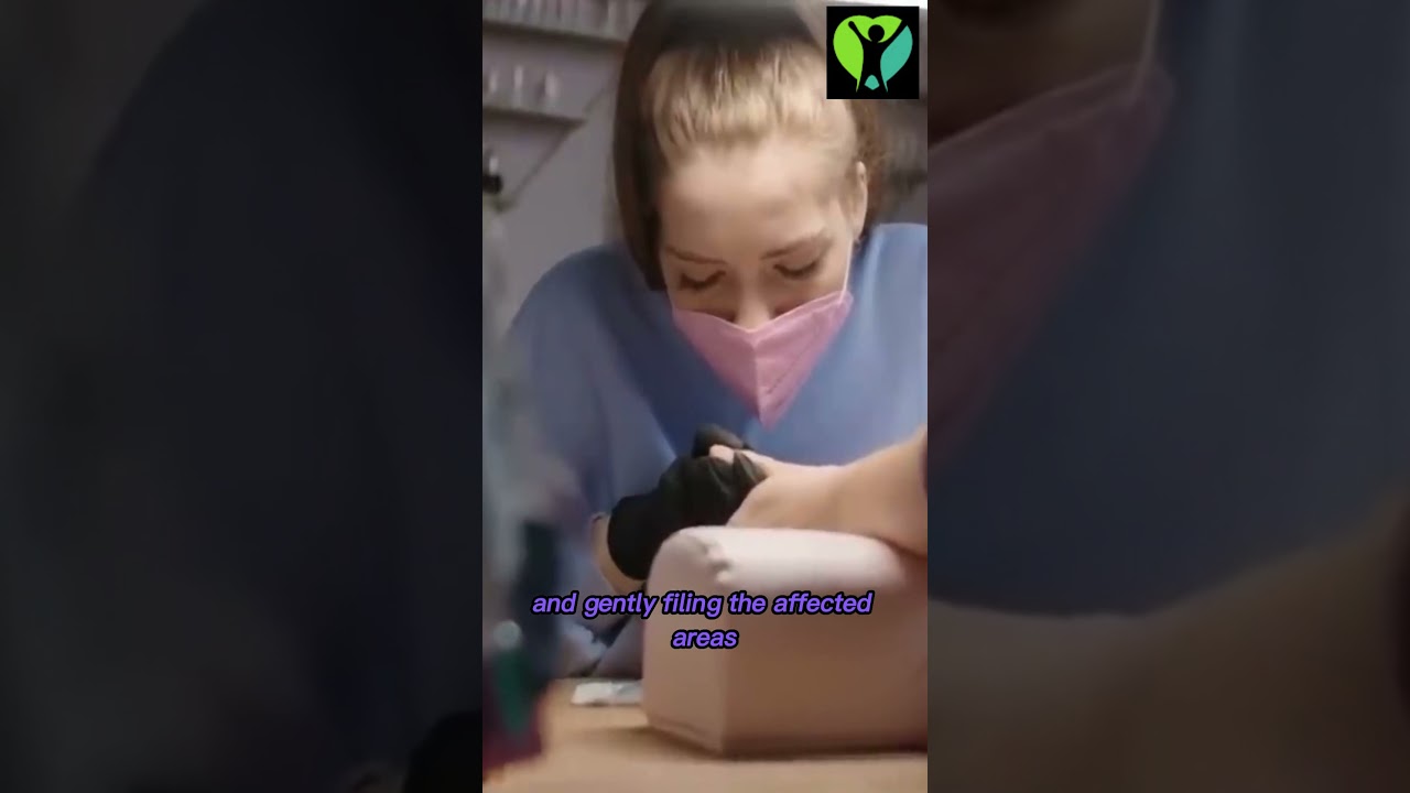 Say Goodbye to Nail Fungus Effective Home Remedies with Tea Tree Oil and Lemon Juice!