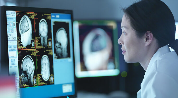 Experts push for acute trials on mushrooms to support cognitive health claims