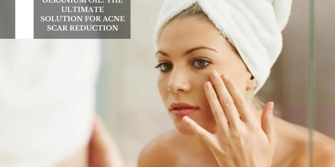 The Ultimate Solution For Acne Scar Reduction
– Moksha Lifestyle Products