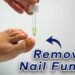 Unleash the Power of Nature: Say Goodbye to Nail Fungus!