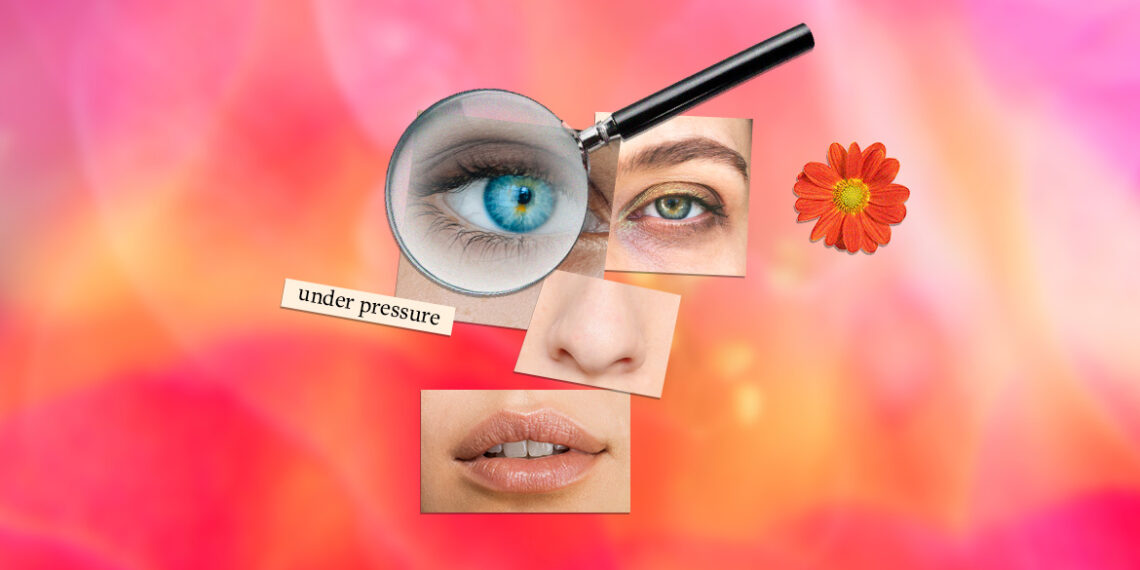 I Was Diagnosed With Idiopathic Intracranial Hypertension at 27