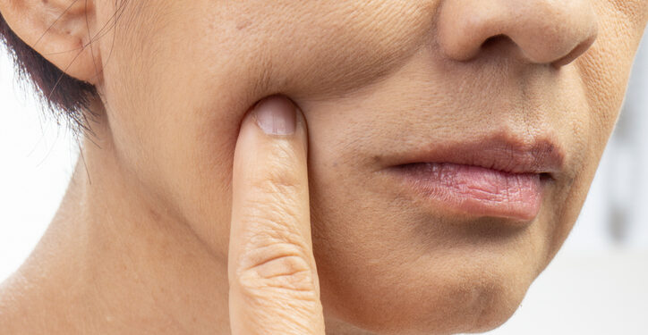 How GLP-1 users can support their skin amid weight loss