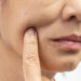How GLP-1 users can support their skin amid weight loss