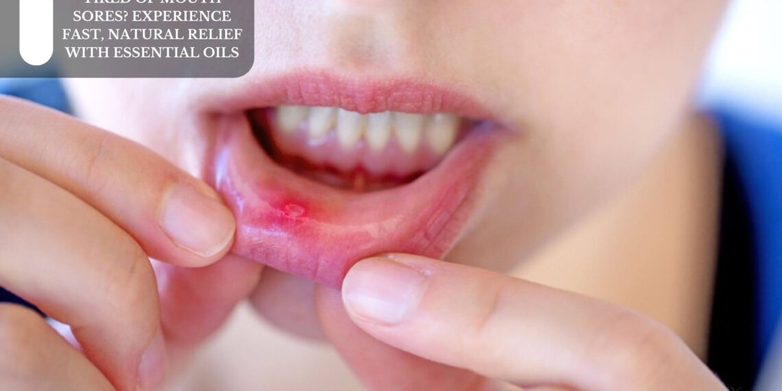 Tired Of Mouth Sores? Experience Fast, Natural Relief With Essential Oils
– Moksha Lifestyle Products