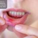 Tired Of Mouth Sores? Experience Fast, Natural Relief With Essential Oils
– Moksha Lifestyle Products