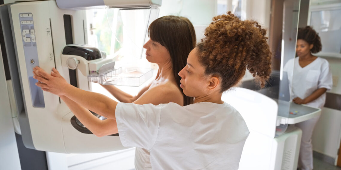 Mammograms Will Now Inform People of Breast Density, per FDA| Well+Good