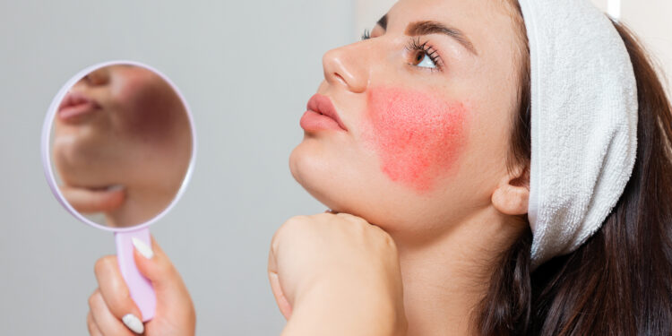 New clinical testing to “investigate microbial roots of various skin conditions”