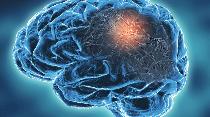 Oxidative stress and gut microbiota’s role in neurodegeneration: Review