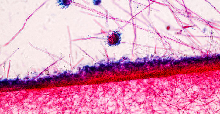 Phytoestrogen complex shows potential for improving menopause symptoms