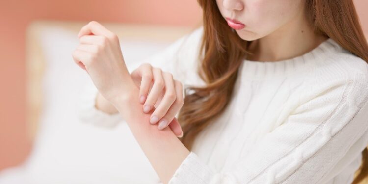 Zinc, selenium intake may reduce atopic dermatitis risk