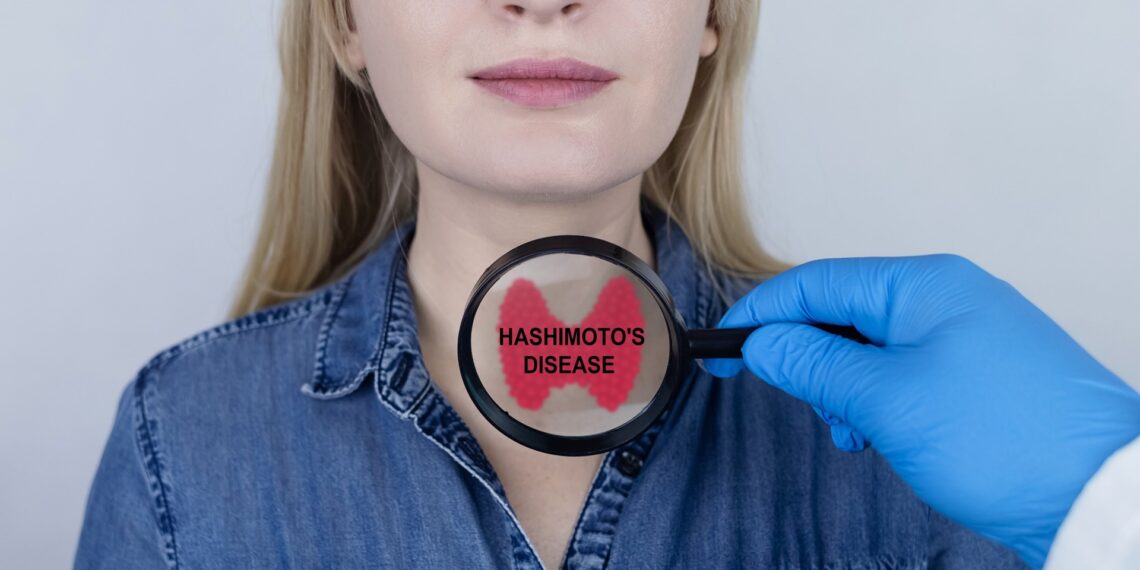 Essential Oils for Hashimoto’s – Vibrant Blue Oils