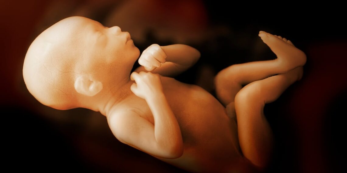 Obese pregnant women missing critical folic acid window