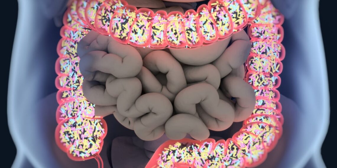 Limosilactobacillus reuteri ZJ617 may mitigate metabolic syndrome via microbiota-synthesized spermidine