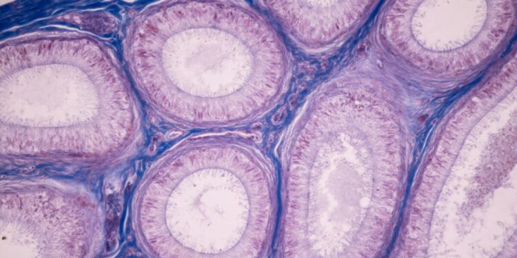 Tuna DHA slows cellar aging improves brain health