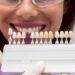 Transforming London Smiles: The Veneer Advantage