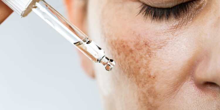 Activ’ Inside on winning the NutraIngredients Beauty Ingredient of the Year