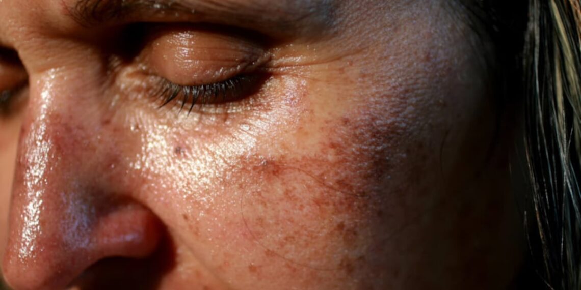 Can supplements protect against UV-induced skin damage?