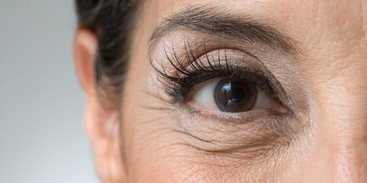 Study finds oral supplement can reduce wrinkles in 12 weeks